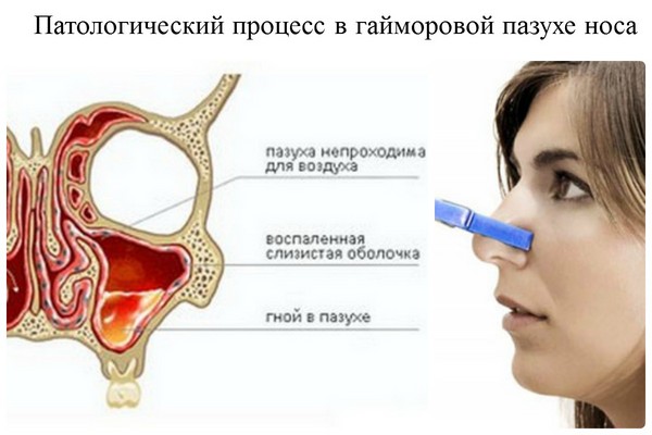 Καφές μύθος: γιατί είναι σημαντικό να ξεκινήσει η θεραπεία έγκαιρα