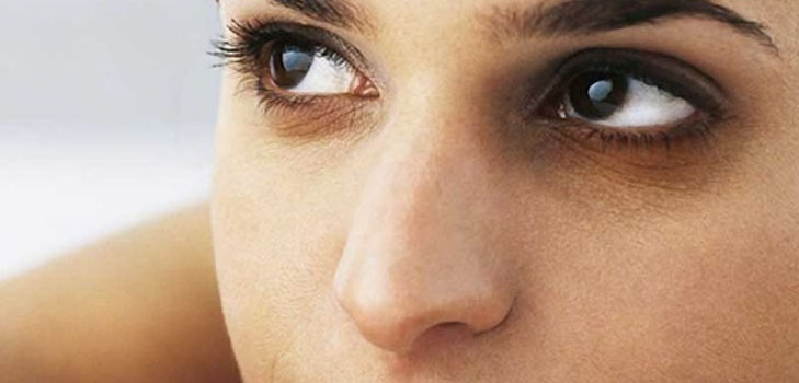 Αποκατάσταση για μώλωπες κάτω από τα μάτια