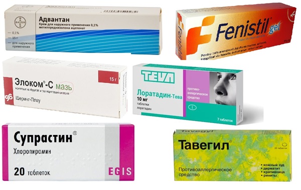 Τσιμπήματα εντόμων
